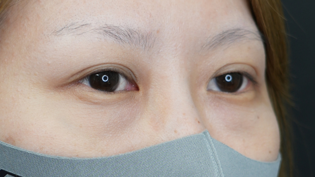 Postoperative Condition Part 1