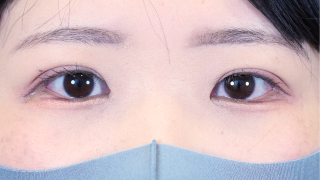 Postoperative Condition Part 1