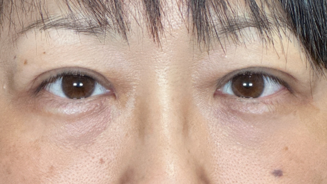 Postoperative Condition Part 1