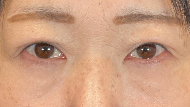 Postoperative Condition Part 1