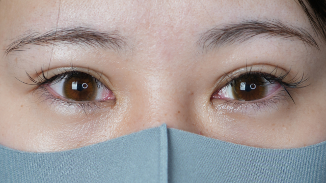 Postoperative Condition Part 1