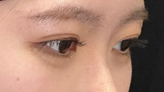 Postoperative Condition Part 1