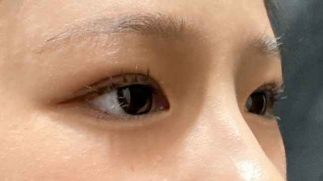 Postoperative Condition Part 1