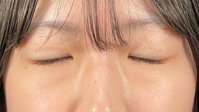 Postoperative Condition Part 1