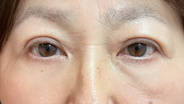 Postoperative Condition Part 1