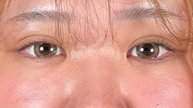 Postoperative Condition Part 1