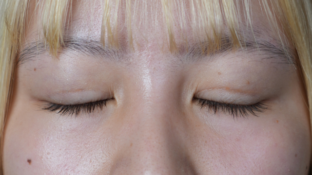 Postoperative Condition Part 1