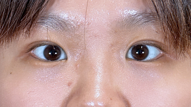 Postoperative Condition Part 1