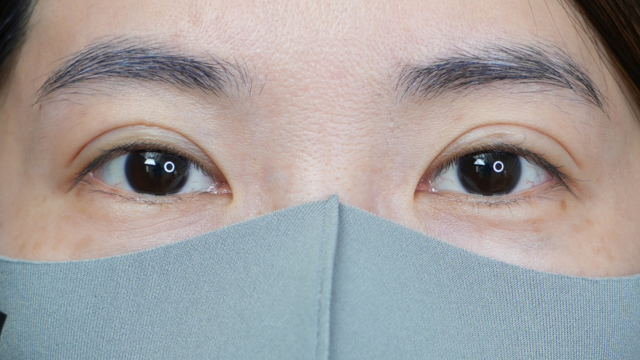 Postoperative Condition Part 1