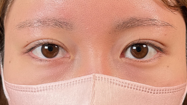 Postoperative Condition Part 1