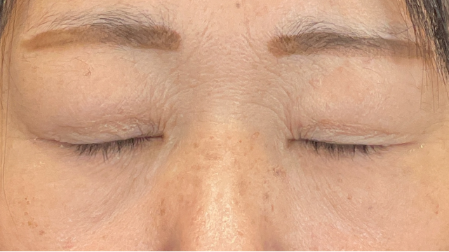 Postoperative Condition Part 1