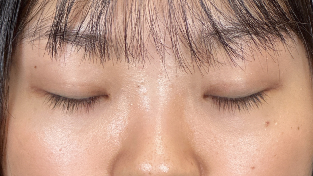 Postoperative Condition Part 1