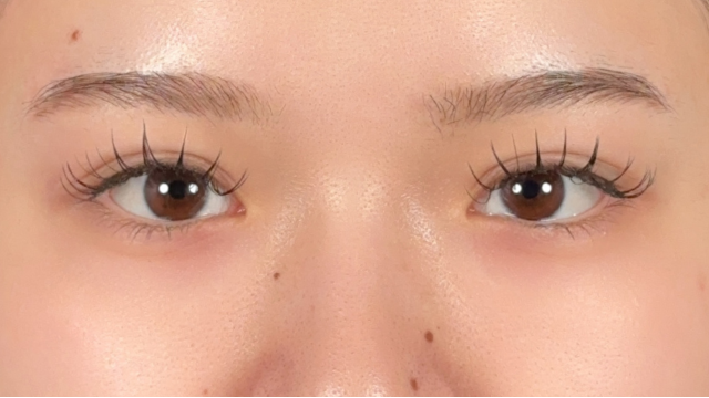 Postoperative Condition Part 1