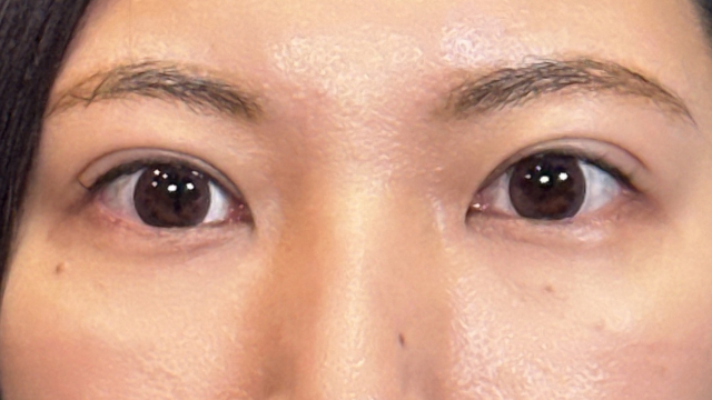 Postoperative Condition Part 1