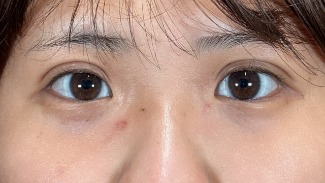 Postoperative Condition Part 1