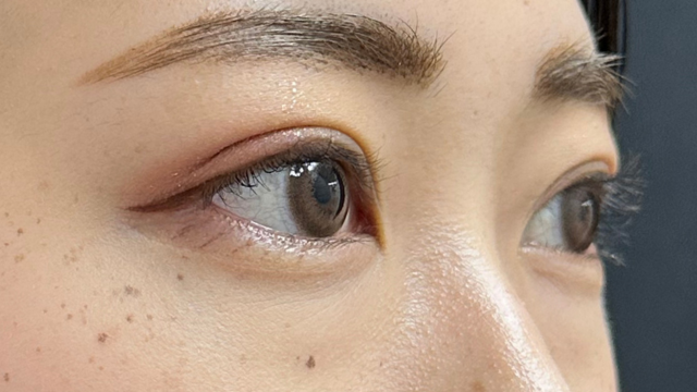 Postoperative Condition Part 1