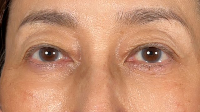 Postoperative Condition Part 1