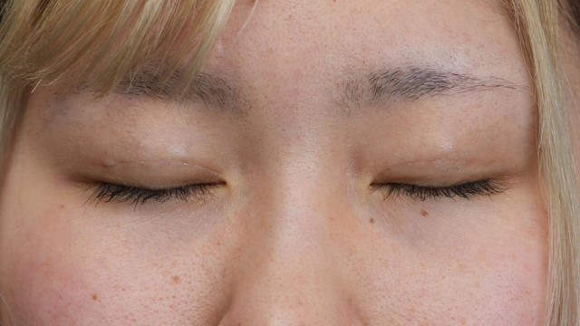 Postoperative Condition Part 1