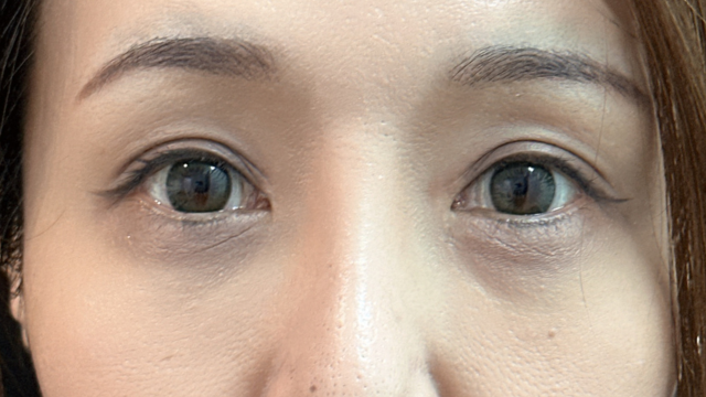 Postoperative Condition Part 1