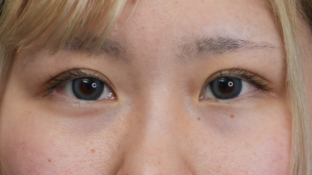 Postoperative Condition Part 1