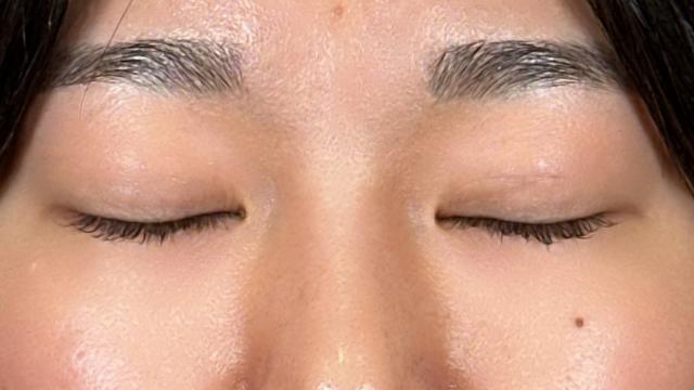 Postoperative Condition Part 1