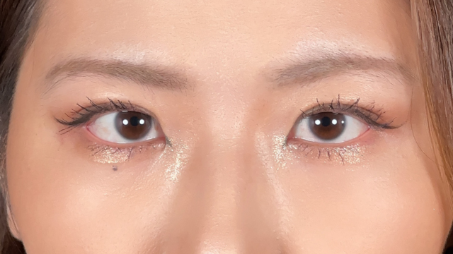 Postoperative Condition Part 1