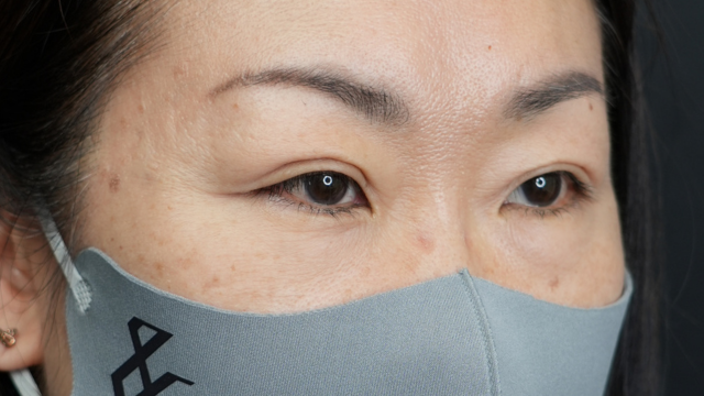 Postoperative Condition Part 1