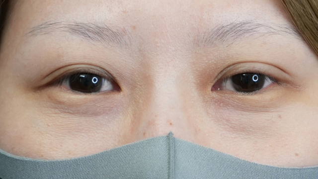 Postoperative Condition Part 1