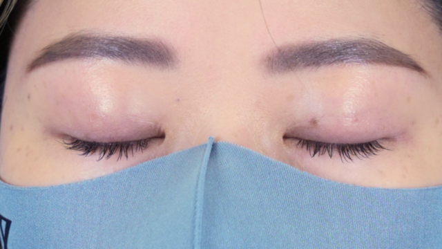 Postoperative Condition Part 1