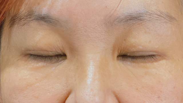 Postoperative Condition Part 1