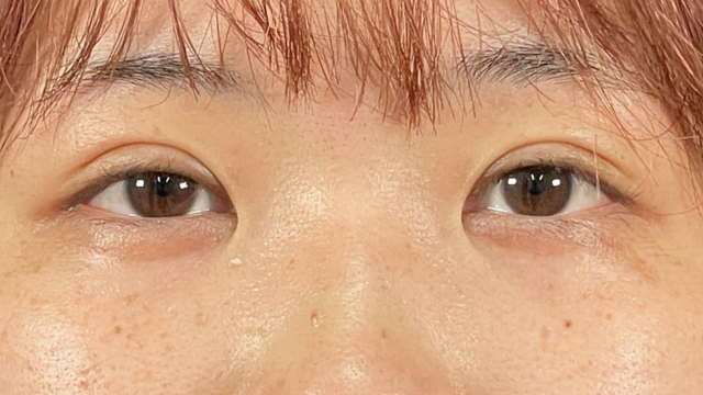 Postoperative Condition Part 1