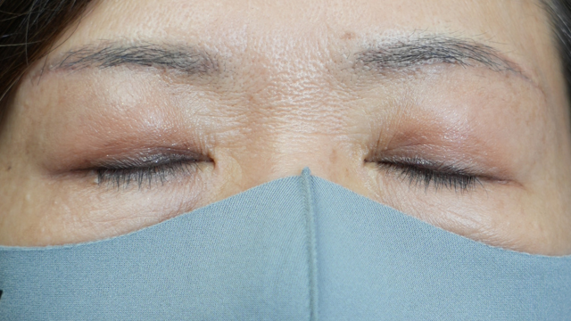 Postoperative Condition Part 1