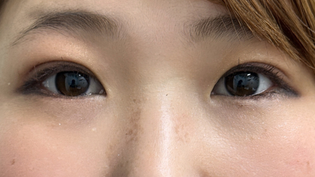 Postoperative Condition Part 1