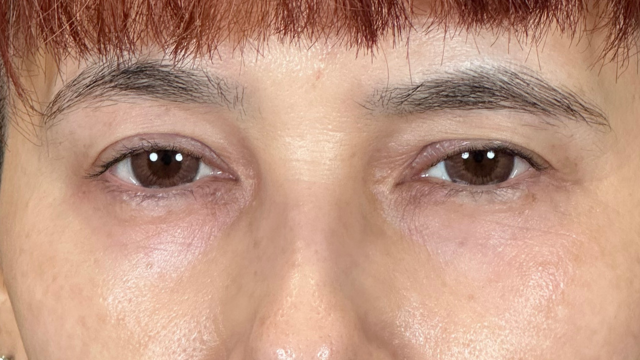 Postoperative Condition Part 1