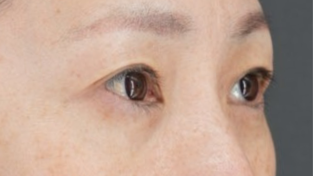 Postoperative Condition Part 1