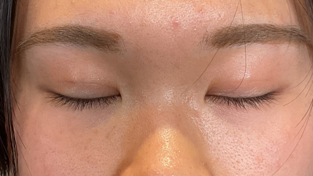 Postoperative Condition Part 1