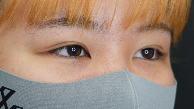 Postoperative Condition Part 1