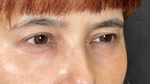 Postoperative Condition Part 1