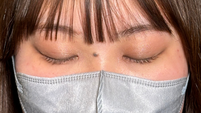 手术前的状态 其一