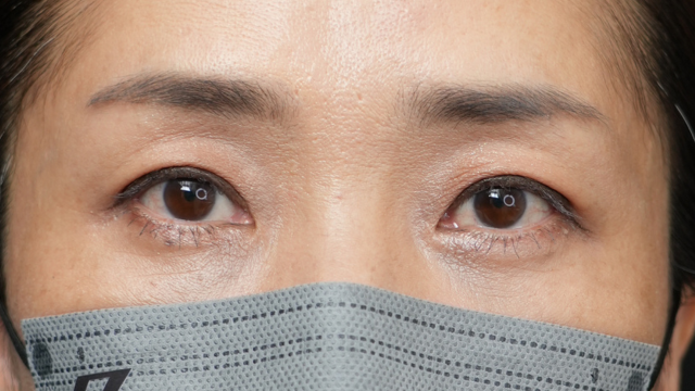 Postoperative Condition Part 1