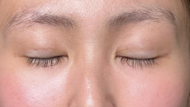 Postoperative Condition Part 1