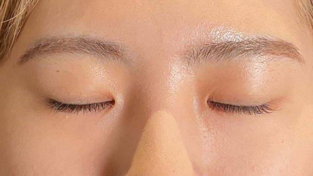 Postoperative Condition Part 1