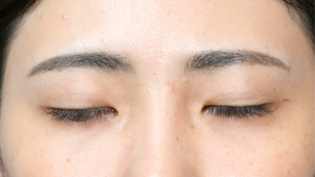 Postoperative Condition Part 1