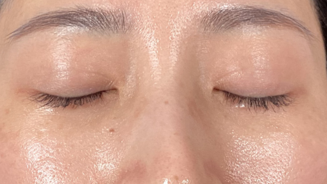 Postoperative Condition Part 1