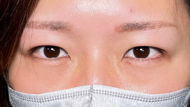 Postoperative Condition Part 1