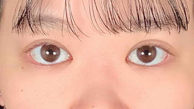 Postoperative Condition Part 1