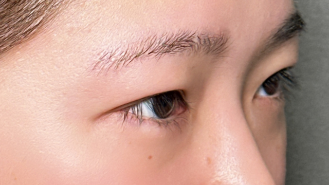 Postoperative Condition Part 1