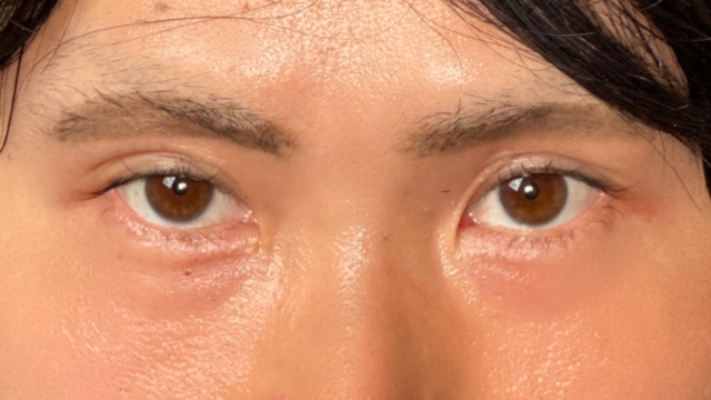 Postoperative Condition Part 1