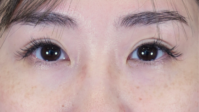 Postoperative Condition Part 1