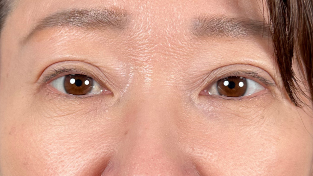 Postoperative Condition Part 1